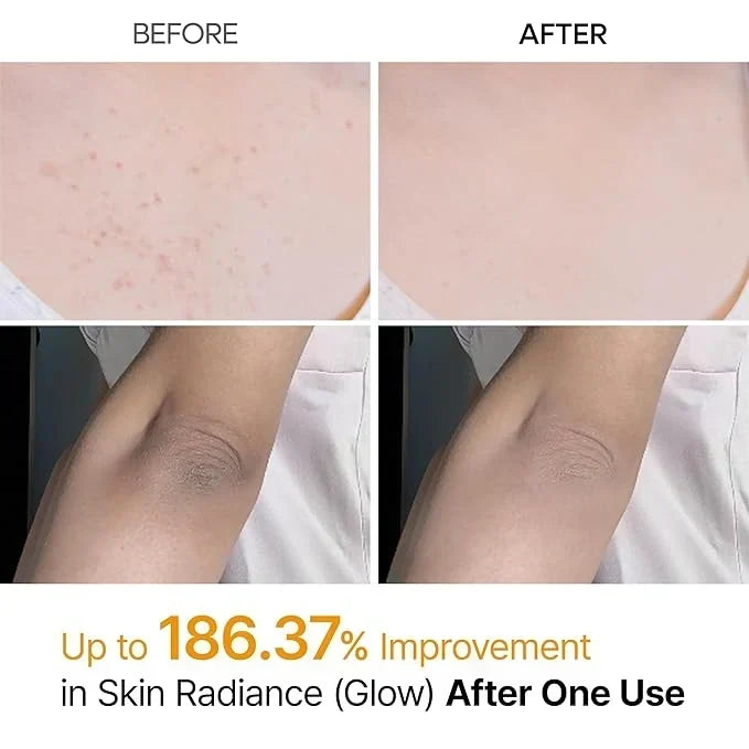 Buy 1 Get 1 Free Dr. Melaxin Kojic Acid Turmeric Spray